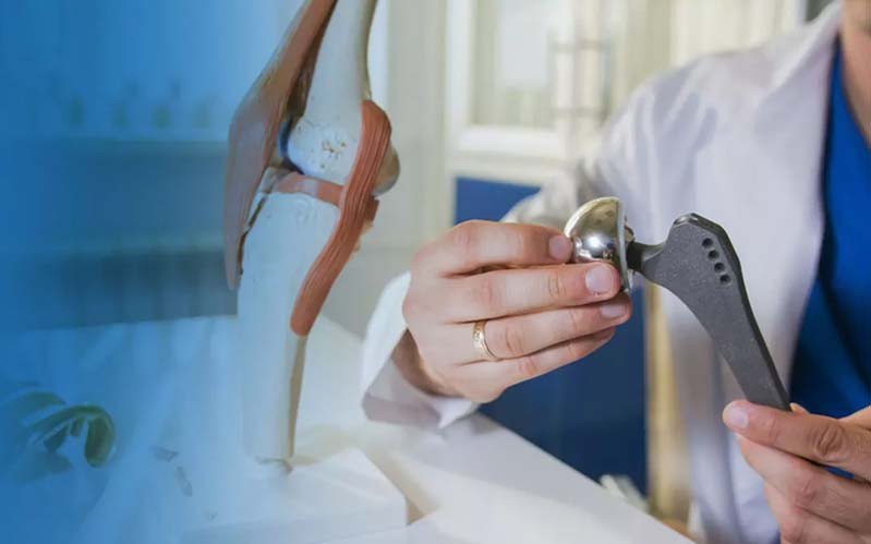 Joint Replacement