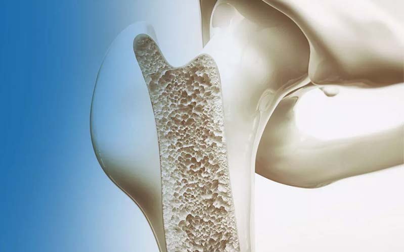 Joint Replacement