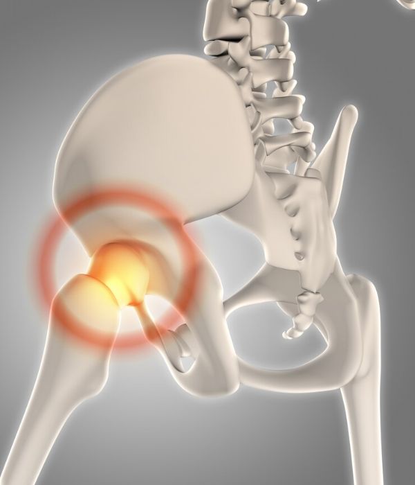 hip arthroscopy greater noida