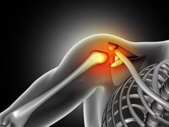 shoulder dislocation treatment