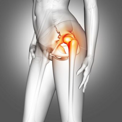 hip replacement surgery noida