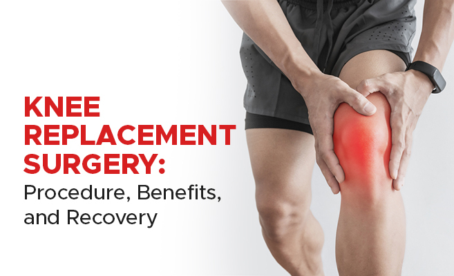 knee replacement surgery in Noida