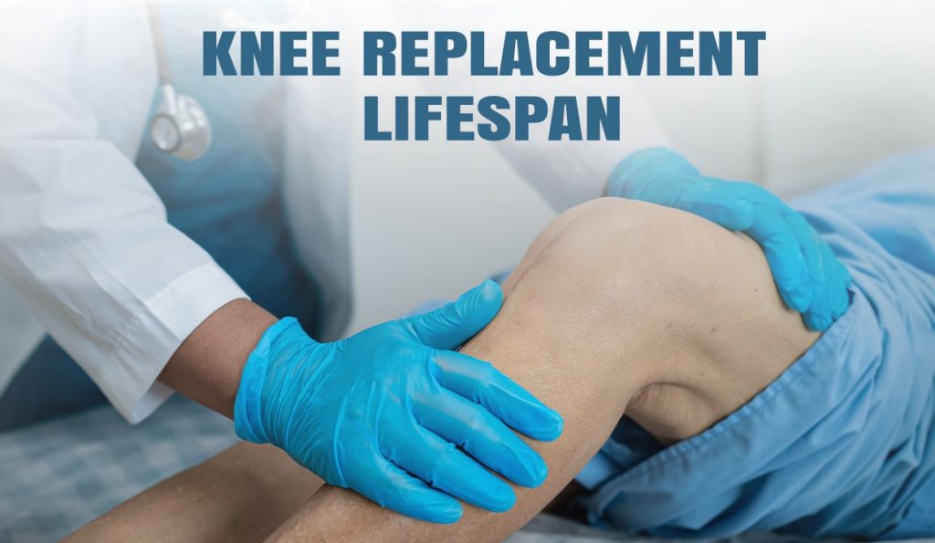 Knee Replacement Lifespan